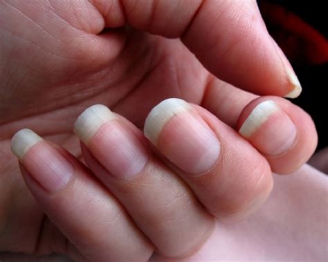  Monthly nail trims are usually enough to keep nails from growing too long